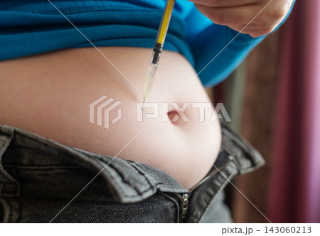 Woman receiving weight loss injections and fat dissolving injections into belly fat at home. Close up of stomach subcutaneous injection, lipolytic, fertility hormone, or insulin therapy. Woman receiving weight loss injections and fat dissolving injections into belly fat at home. Close up of stomach subcutaneous injection, lipolytic, fertility hormone, or insulin therapy. 143060213