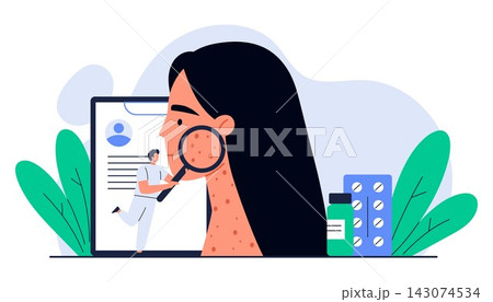 Woman with acne and skin rash on her face and neck. Tiny dermatologist examines irritated skin with a magnifying glass. Allergy treatment concept. Isolated vector illustration in cartoon style 143074534