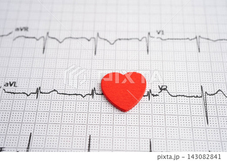 Electrocardiogram ECG, heart wave, heart attack, cardiogram report. Electrocardiogram ECG, heart wave, heart attack, cardiogram report. 143082841