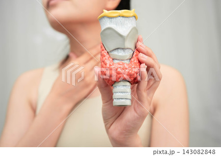 Hyperthyroidism, Overactive Thyroid, Thyroid Lymphoma, Asian woman with thyroid gland human anatomy model. Hyperthyroidism, Overactive Thyroid, Thyroid Lymphoma, Asian woman with thyroid gland human anatomy model. 143082848