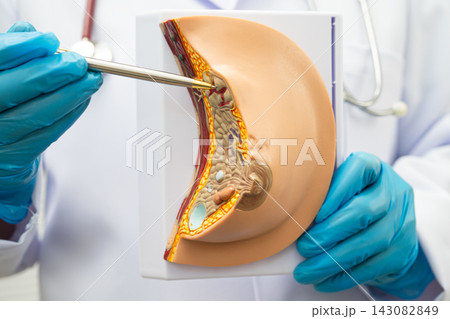 Doctor holding female breast human anatomy model. 143082849