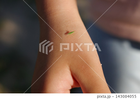 子供の手の甲にとまった小さな幼虫のバッタ 143084055