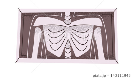 Xray Chest Ribcage Scan Medical Cartoon Xray Chest Ribcage Scan Medical Cartoon 143111943