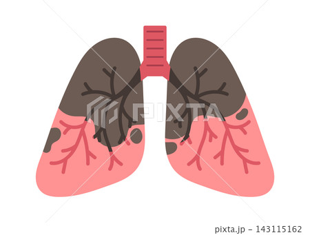 Lung Disease Anatomy Diagram Medical Cartoon Lung Disease Anatomy Diagram Medical Cartoon 143115162