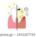 健康な歯・不健康な歯 143187735