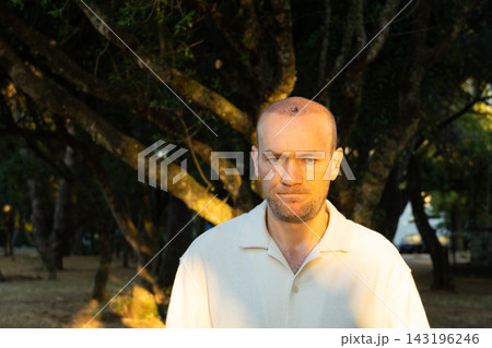 Serious worried man after hair transplant looking at camera in Portugal park Serious worried man after hair transplant looking at camera in Portugal park 143196246