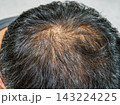 薄毛で頭皮が見えている男性の頭① 143224225