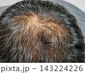 薄毛で頭皮が見えている男性の頭② 143224226