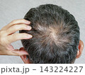 薄毛で頭皮が見えている男性の頭③ 143224227
