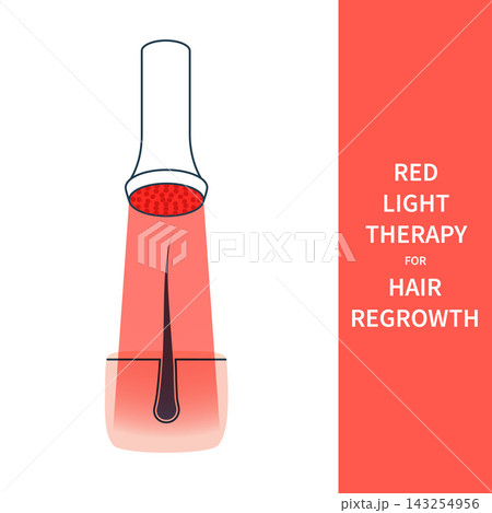 Red Hair Regrowth Panel Vector Illustration Red Hair Regrowth Panel Vector Illustration 143254956