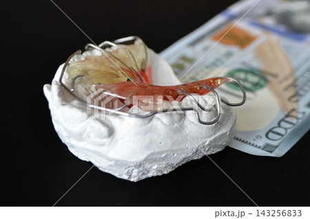 Plaster cast of teeth and dental plate on the background of money 143256833