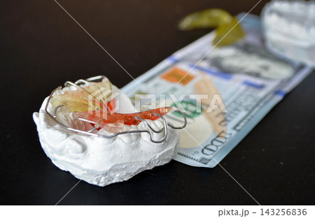 Plaster cast of teeth and dental plate on the background of money Plaster cast of teeth and dental plate on the background of money 143256836
