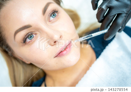 Close-up of woman face and hand in surgical glove holding syringe near her lips, ready to receive beauty treatment. Injection cosmetology, lips augmentation and correction concept. Close-up of woman face and hand in surgical glove holding syringe near her lips, ready to receive beauty treatment. Injection cosmetology, lips augmentation and correction concept. 143278554