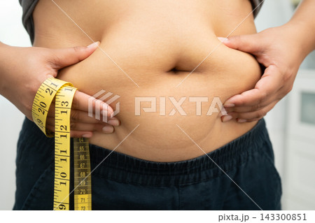 Asian woman with fat belly big size overweight and obesity with measure tape. 143300851