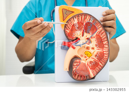 Chronic kidney disease, doctor with model for treatment urinary system, urology, Estimated glomerular filtration rate eGFR. Chronic kidney disease, doctor with model for treatment urinary system, urology, Estimated glomerular filtration rate eGFR. 143302955