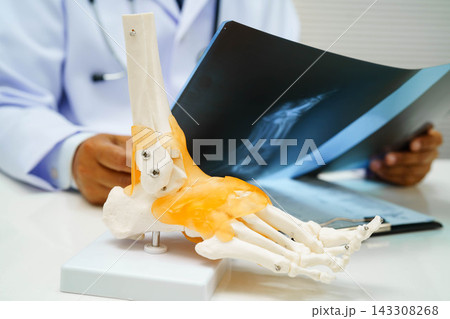 Doctor examining foot ankle joint bone radiography xray film. Doctor examining foot ankle joint bone radiography xray film. 143308268