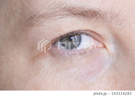 Human Eye Open Showing Iris Pupil And Surrounding Facial Skin Texture In Close Up Facial Crop Under Human Eye Open Showing Iris Pupil And Surrounding Facial Skin Texture In Close Up Facial Crop Under 143314283