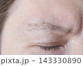 Closed Eye With Relaxed Eyelid And Visible Brow Hairs In Close Up Skin Study Showing Fine Lines 143330890