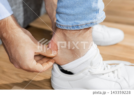 Man applying plaster to heel blister caused by shoe friction and pain. Bandage application, skin protection, sore foot wound care, and health relief for tight, uncomfortable shoes. 143359228