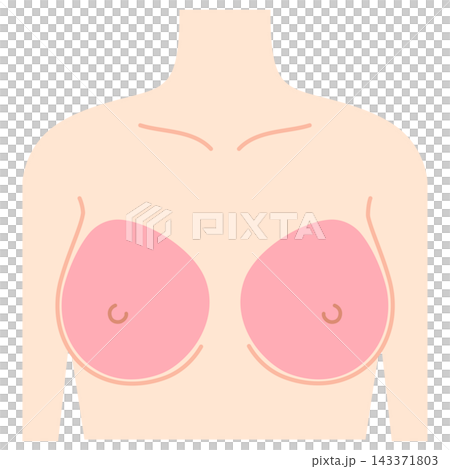 Breast augmentation, breast design, hyaluronic acid injection sites 143371803