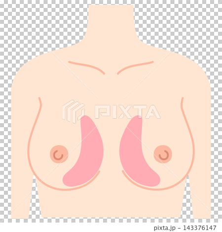 Breast augmentation, breast design, hyaluronic acid injection sites Breast augmentation, breast design, hyaluronic acid injection sites 143376147