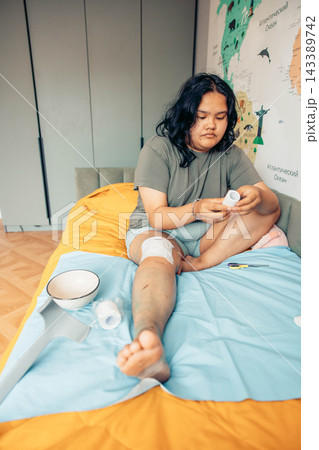 plus size young woman sitting on bed and applying a gauze bandage to her injured leg at home. visible scars and bruising on the knee and thigh. home first aid, wound care, injury recovery 143389742