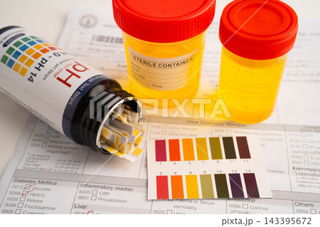 Urinalysis, urine cup with reagent strip pH paper test and comparison chart in laboratory. Urinalysis, urine cup with reagent strip pH paper test and comparison chart in laboratory. 143395672