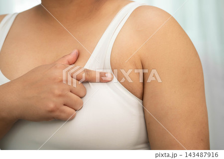 Asian big size overweight woman show armpit fat body. 143487916
