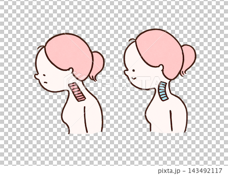正常頸椎與頸部筆直的女性的比較圖。 143492117