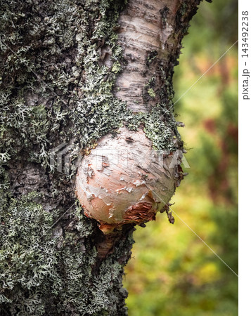 Unique Rounded Tree Burl on Lichen Covered Birch Trunk 143492238