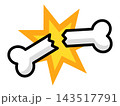 衝撃でポッキリと折れた骨の骨折イラスト 143517791