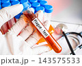 Gloved hand holding Plague Test blood tube with laboratory rack, infectious disease diagnostic testing concept 143575533
