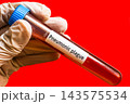 Gloved hand holding Pneumonic Plague labeled blood tube on red background, infectious disease medical testing concept 143575534