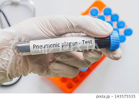 Gloved hand holding Pneumonic Plague labeled blood tube, infectious disease medical testing concept Gloved hand holding Pneumonic Plague labeled blood tube, infectious disease medical testing concept 143575535