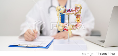 Doctor with human Colon anatomy model. Colonic disease, Large Intestine, Colorectal cancer, Ulcerative colitis, Diverticulitis, Irritable bowel syndrome, Digestive system and Healthcare concept Doctor with human Colon anatomy model. Colonic disease, Large Intestine, Colorectal cancer, Ulcerative colitis, Diverticulitis, Irritable bowel syndrome, Digestive system and Healthcare concept 143601148