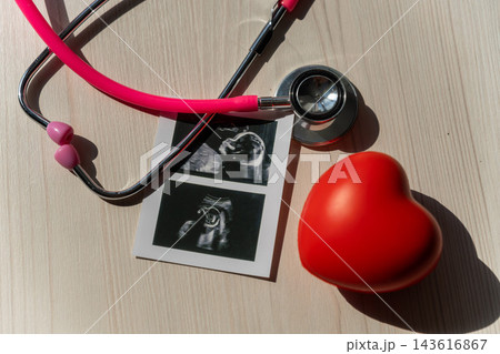 Photo: Ultrasound screening of a child and stethoscope. Image of an embryo. Photo: Ultrasound screening of a child and stethoscope. Image of an embryo. 143616867