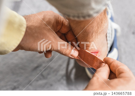 Man applying adhesive bandage on painful foot blister from uncomfortable tight shoes, blister treatment, sore foot, foot irritation and walking pain, first aid for footwear problem Man applying adhesive bandage on painful foot blister from uncomfortable tight shoes, blister treatment, sore foot, foot irritation and walking pain, first aid for footwear problem 143665788