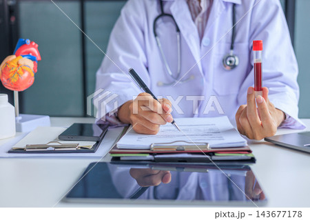 Medical worker checking biochemistry blood screening report on desk. 143677178