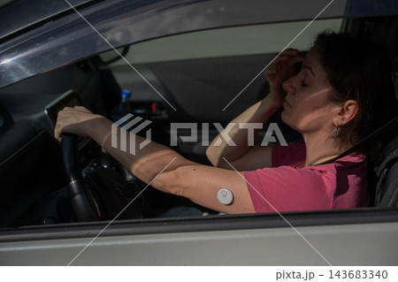 A woman wearing a continuous glucose monitor is driving a car. A woman wearing a continuous glucose monitor is driving a car. 143683340