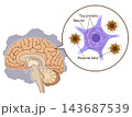 The Alzheimer's Brain: Amyloid-beta & Tau Protein 143687539