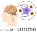 The Alzheimer's Brain: Amyloid-beta & Tau Protein 143687543