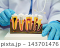 Dentist holding dental implant, artificial tooth roots into jaw, root canal of dental treatment, gum disease, teeth model for dentist. 143701476