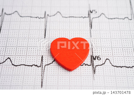 Electrocardiogram ECG, heart wave, heart attack, cardiogram report. 143701478