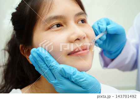 Asian woman receiving lip contouring procedure augmentation performed on face. 143701492