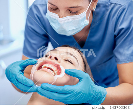 Woman, dentist and mouth inspection for hygiene treatment, teeth whitening and healthcare procedure of veneer implant. Doctor, female patient and orthodontics consultation, surgery or wellness 143703368