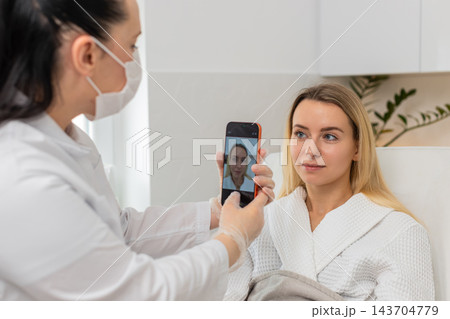 Cosmetologist takes smartphone photo of young woman facial skin before cosmetic treatment in clinic Cosmetologist takes smartphone photo of young woman facial skin before cosmetic treatment in clinic 143704779