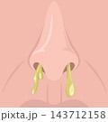 Close-up cartoon vector   background of a face with a runny nose 143712158