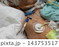An older hospital patient rests pillow tubing near the face monitoring electrodes the chest wires across the body while green fabric bedding surround the bedside view 143753517