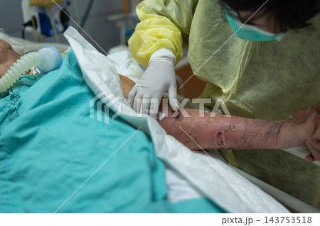 A healthcare worker wearing gloves face mask protective gown leans over patient arm during bedside care green bedding equipment visible the hospital room background A healthcare worker wearing gloves face mask protective gown leans over patient arm during bedside care green bedding equipment visible the hospital room background 143753518