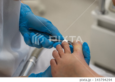 Clinician trims patients big toenail with stainless steel nippers in treatment room. Podiatry care focuses on precise nail grooming, with foot supported by gloved hands during careful trimming. Clinician trims patients big toenail with stainless steel nippers in treatment room. Podiatry care focuses on precise nail grooming, with foot supported by gloved hands during careful trimming. 143794294
